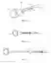 Fig. 16 - Devices and assays for diagnosis of sinusitis