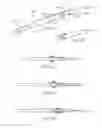 Fig. 17 - Devices and assays for diagnosis of sinusitis
