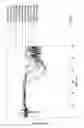 Fig. 06 - Evaluating and imaging volumetric void space location for cement evaluation