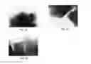 Fig. 03 - Toner