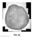Fig. 35 - AUTOMATED DEVICES, SYSTEMS, AND METHODS FOR THE FABRICATION OF TISSUE