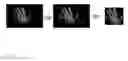 Fig. 05 - Gesture Control Module