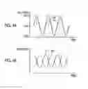 Fig. 04 - Input device for detecting an electrostatic capacitance of an object