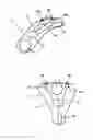 Fig. 02 - Method for controlling a hearing device via touch gestures, a touch gesture controllable hearing device and a method for fitting a touch gesture controllable hearing device