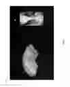 Fig. 06 - Method and system for enhanced visualization and navigation of three dimensional and four dimensional medical images