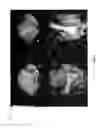 Fig. 07 - Method and system for enhanced visualization and navigation of three dimensional and four dimensional medical images