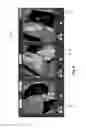Fig. 07 - System and method of mapping medical image of single heart chamber