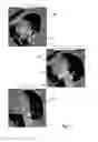 Fig. 08 - System and method of mapping medical image of single heart chamber