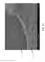 Fig. 05 - Oxide on edges of metal anode foils