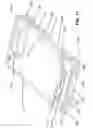 Fig. 10 - PROTECTIVE COVER FOR ELECTRONIC DEVICE