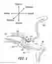Fig. 02 - Canal hearing devices and batteries for use with same