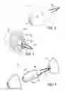 Fig. 03 - Canal hearing devices and batteries for use with same