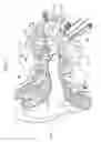 Fig. 02 - Implantable middle ear transducer having diagnostic detection sensor