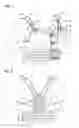 Fig. 02 - Thoracic compression bra
