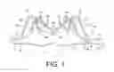 Fig. 02 - System for minimizing multi-dimensional displacement of the body