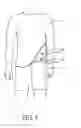 Fig. 06 - WEARING SET CAPABLE OF PREVENTING OVERLAPPED ARTICLES FROM SLIDING PAST EACH OTHER