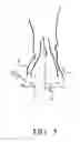 Fig. 06 - Device for three-dimensional foot motion control and plantar pressure redistribution