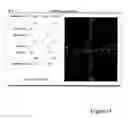 Fig. 08 - METHODS AND SYSTEMS FOR ANATOMICAL STRUCTURE AND TRANSCATHETER DEVICE VISUALIZATION