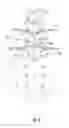 Fig. 07 - PERCUTANEOUS SYSTEM AND METHODS FOR ENHANCED EPIDURAL ACCESS FOR SPINE SURGERY