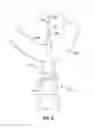 Fig. 06 - Coring dilator for defining an aperture in a tissue wall