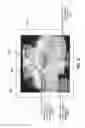 Fig. 06 - Imaging and display system for guiding medical interventions