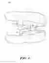 Fig. 02 - ORAL APPARATUSES AND METHODS FOR MANDIBULAR JAW MANIPULATION