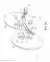 Fig. 02 - Gluteal implants and implant systems