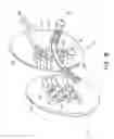 Fig. 03 - Gluteal implants and implant systems