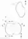 Fig. 17 - Gluteal implants and implant systems
