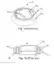 Fig. 02 - Suturing ring for prosthetic heart valves