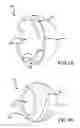 Fig. 02 - Constrained dual mobility hip prosthesis system and method