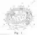 Fig. 02 - Radially expandable spinal interbody device and implantation tool