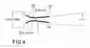 Fig. 08 - Fallopian Tube Occluding Device, Delivery Catheter and Method