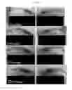 Fig. 09 - Compositions and methods for treating alopecia