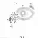 Fig. 03 - Sustained release delivery of active agents to treat glaucoma and ocular hypertension