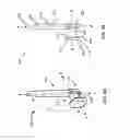Fig. 04 - Sustained release delivery of active agents to treat glaucoma and ocular hypertension