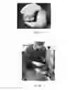 Fig. 02 - Spinal disc regenerative composition and method of manufacture and use