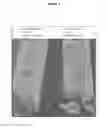 Fig. 04 - METHODS AND MEANS FOR PROTECTING THE SKIN AGAINST PATHOGENIC MICROORGANISMS