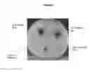 Fig. 06 - METHODS AND MEANS FOR PROTECTING THE SKIN AGAINST PATHOGENIC MICROORGANISMS
