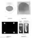 Fig. 16 - Sterilization and filtration of peptide compositions