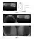 Fig. 07 - Method for preparing mammalian tissue for storage, implant, and transplant