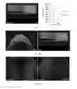 Fig. 08 - Method for preparing mammalian tissue for storage, implant, and transplant
