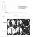 Fig. 04 - Dental barrier membrane using cocoon and method for manufacturing same