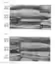 Fig. 05 - Dental barrier membrane using cocoon and method for manufacturing same