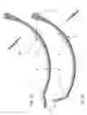 Fig. 02 - Imaging competent, bi-directionally articulable endotracheal tubes