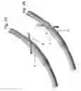 Fig. 03 - Imaging competent, bi-directionally articulable endotracheal tubes