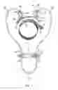 Fig. 02 - Apparatuses and methods to increase neck strength and limit concussion risk
