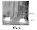 Fig. 04 - Fluid Delivery Devices, Systems, and Methods