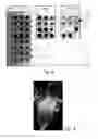 Fig. 04 - Bioactive Protein, Use Thereof and Method for its Production