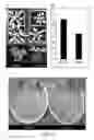 Fig. 11 - Bioactive Protein, Use Thereof and Method for its Production